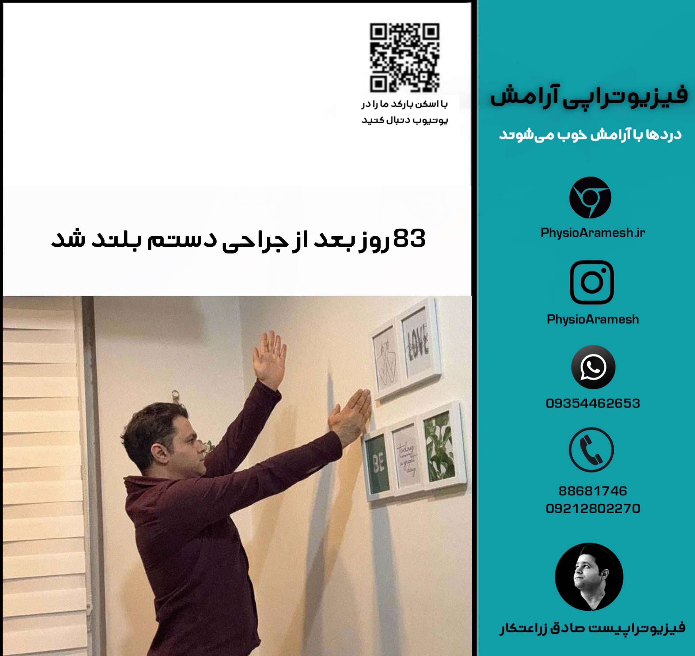 83 روز بعد از جراحی دستم بلند شد